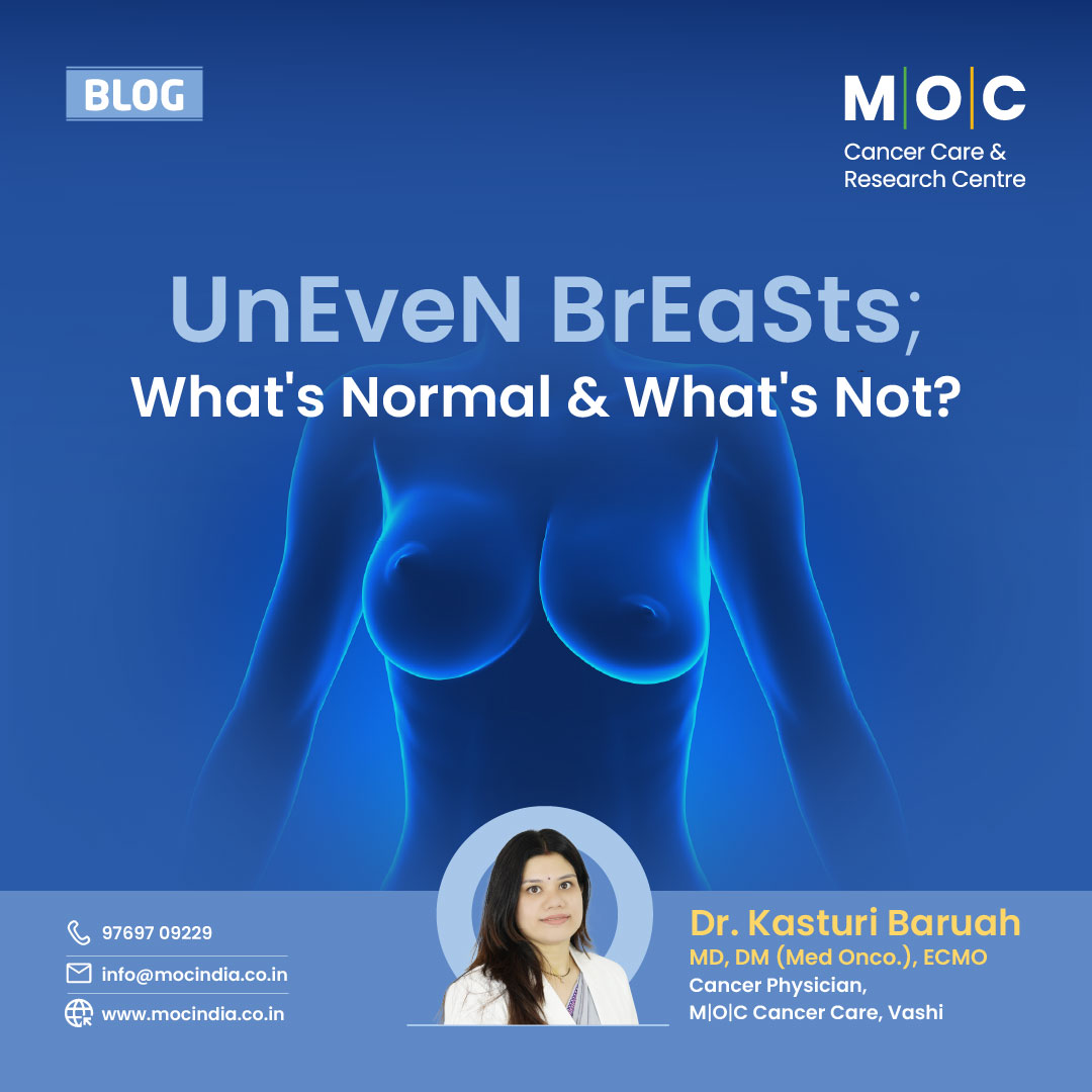 One Breast Bigger Than the Other: Normal or a Warning Sign?